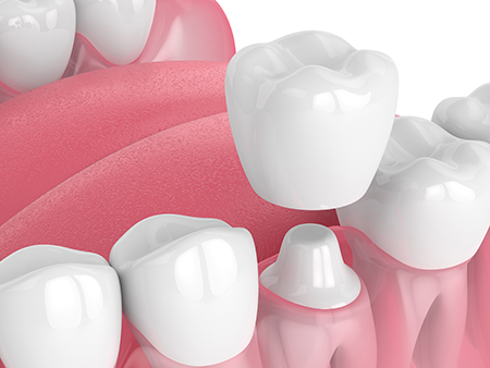 Ahwatukee Dentistry, PLLC